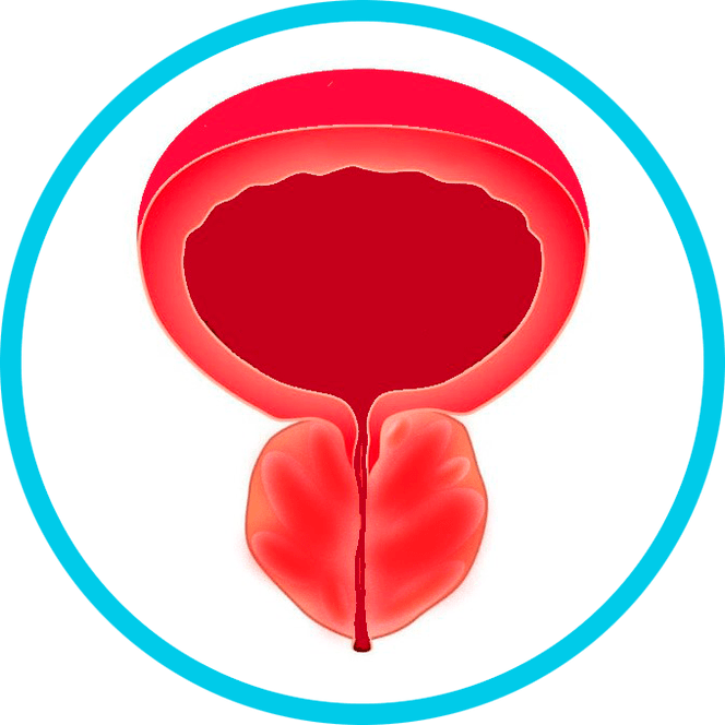 Prostatitisaren sintomak